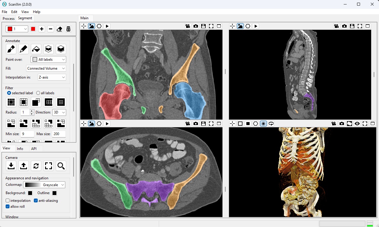 ScanXm Software Screenshot