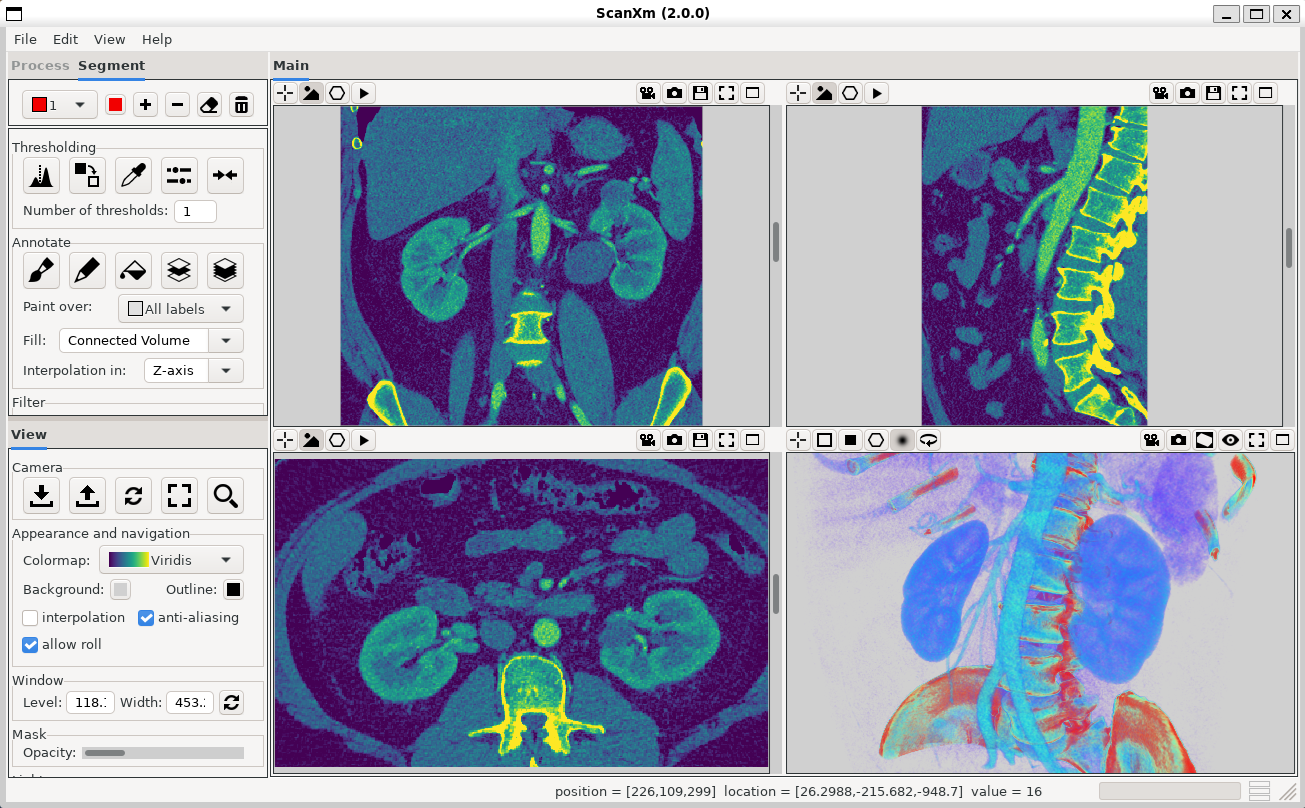ScanXm Screenshot 2